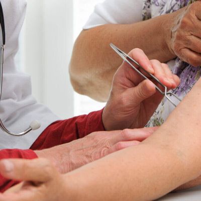 Borelioza - diagnostyka, postępowanie w praktyce lekarza POZ