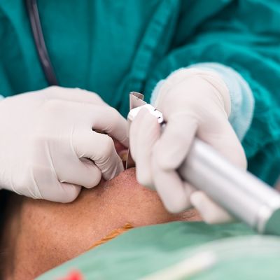 Intubacja i obsługa respiratora. Interwencje u pacjenta z niewydolnością oddechową w obliczu pandemii SARS-CoV-2