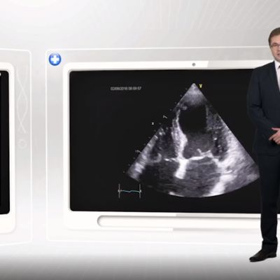 Echokardiografia. Przypadek 1